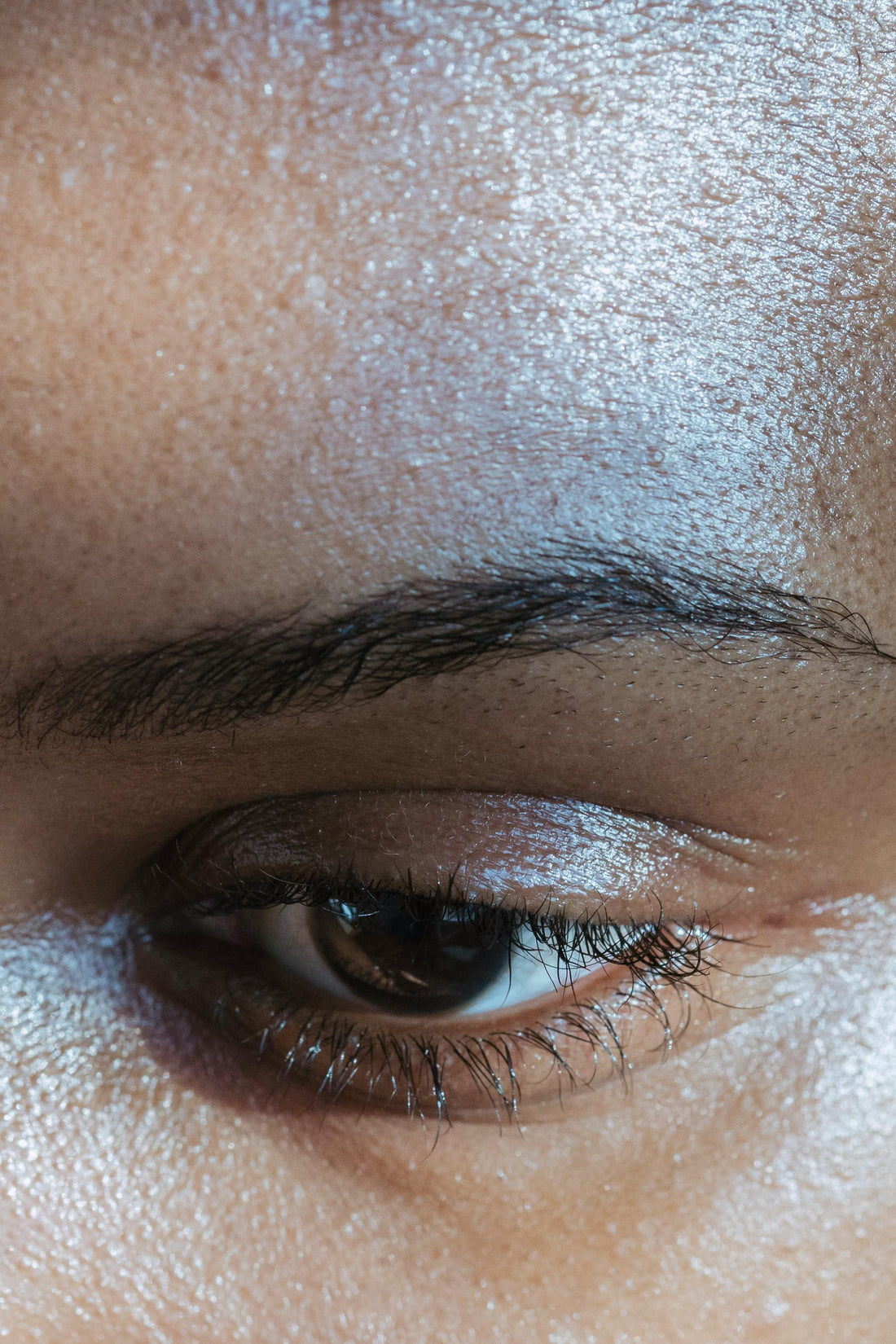 A close up image of white spots on the face that are not pimples